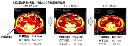 もっとも効果が出た人のCT断面図。ぱっと見でもかなり違うのがわかる。これ、マジ？