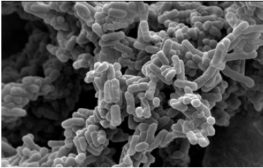 植物性乳酸菌「K-2」の電子顕微鏡写真