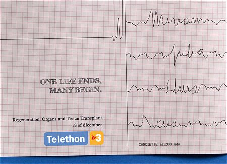 ↑ 一本の直線となった心電図が複数に枝分かれ。そして「一つの生命が終わり、そしてたくさんの命が始まる」のコピーが躍る