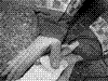 治療